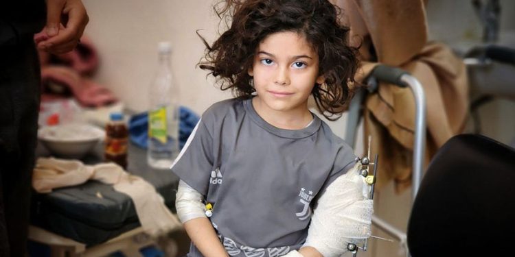 İşğalçıların Qəzzəyə olan hücumları nəticəsində fələstinli uşaqların daimi əlilliyi-Fotolar