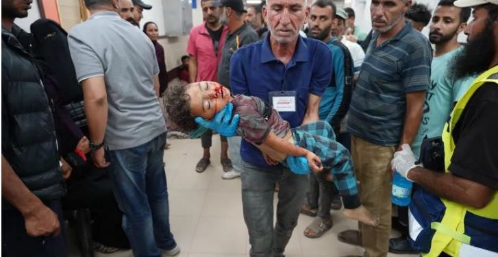 ÜST: Qəzzədə 32 nəfər qida çatışmazlığı nəticəsində həyatını itirib