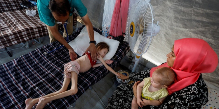 İsrailin blokadası səbəbindən Qəzzada 60-dan çox fələstinli uşaq aclıqdan həyatını itirib