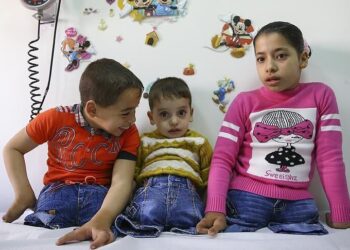 Hər gün 10 fələstinli uşaq ayağını itirir