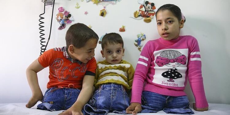 Hər gün 10 fələstinli uşaq ayağını itirir