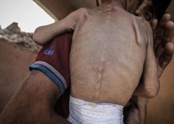 620 fələstinli aclıq və dərman çatışmazlığı səbəbindən ölüb/69-u uşaqdır