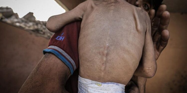 620 fələstinli aclıq və dərman çatışmazlığı səbəbindən ölüb/69-u uşaqdır