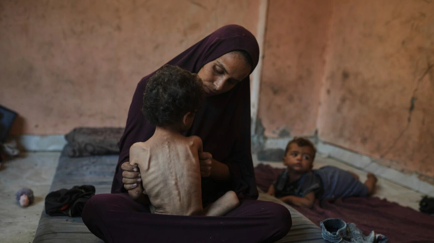 Qəzza rəsmiləri xəbərdarlıq edir: İsrailin yardım blokadası səbəbindən 100,000 uşaq dərhal ölüm təhlükəsi altındadır