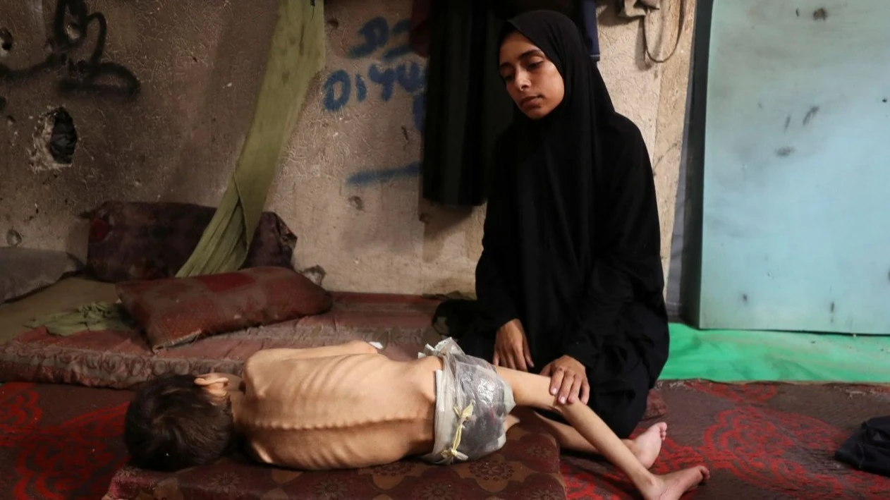 Qəzzada aclıq “bu əsrdə görünməmiş bir vəziyyətdir,” ekspertlər xəbərdarlıq edir