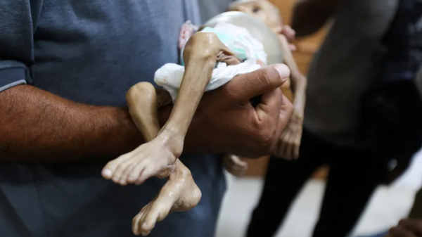 Daha 7 fələstinli aclıqdan ölüb