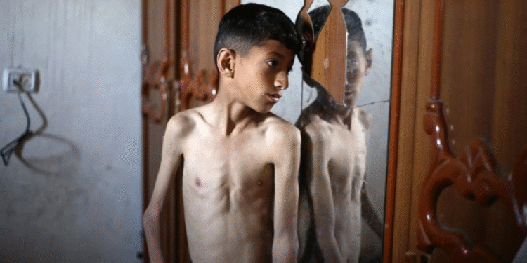 Qəzza aclıq təhlükəsinin astanasında – BMT: İsrail mülki əhalini aclıqdan öldürür