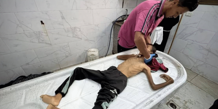 Aclıq Qəzza zolağında saatlar içində 4 nəfərin, o cümlədən 2 uşağın həyatına son qoydu