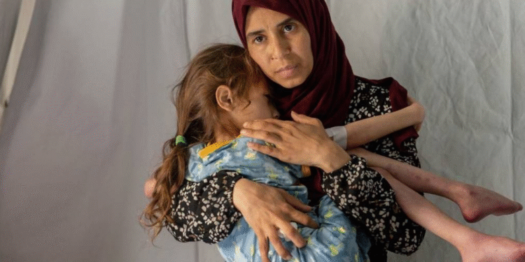 Sərhədsiz Həkimlər: Qəzzada görünməmiş səviyyədə qidalanma pozğunluğu və qadınlarla uşaqların məqsədli aclığa məruz qoyulması